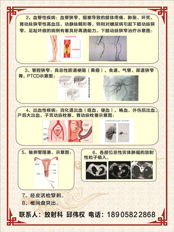 长兴县中医院介入治疗介绍